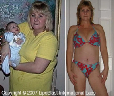 Quick Weight Loss Pills That Work Fast! Belly Best Fat Burner Diet Slim Powerful - Image 1 of 4