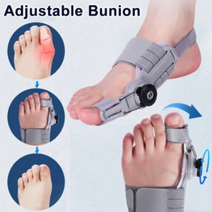 Treatmedy Bunion Fix Toe Valgus Corrector Foot Pain Relief Toe Straightener - Picture 1 of 20