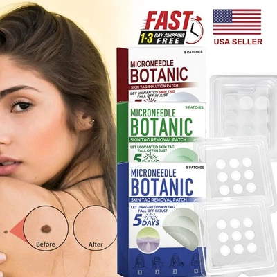 MICRONEEDLE BOTANIC Skin Tag & Acne Patch Skin Tag Remover Patches 9Pcs HOT 2025 - Image 1 of 4
