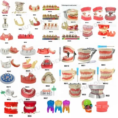 Dental Typodont Teeth Model Implant Pathological Perio Restoration Practice Demo - Image 1 of 4