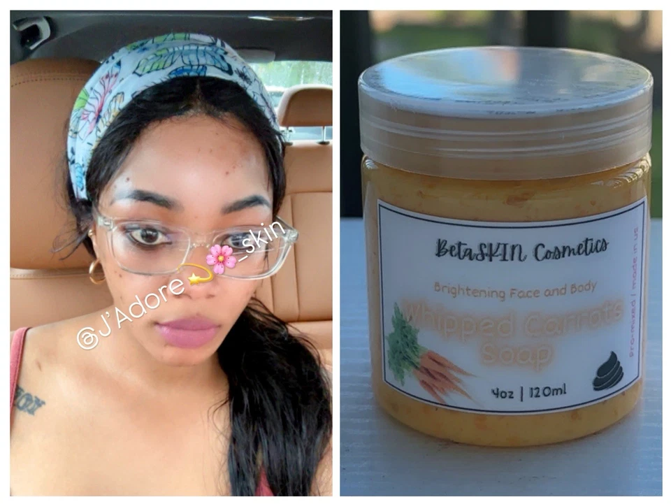 5D extreme brightening Molato Soap 4oz - Image 1 of 1