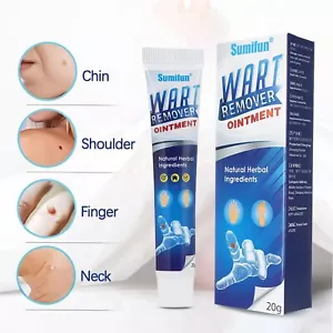 Wart Removing Ointment Safe Efficient Wart-Relieving Agent For Hand Foot, Face - Picture 1 of 9