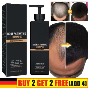 Champú activador de raíces, champú para caída del cabello, champú activador de raíces - Imagen 1 de 11
