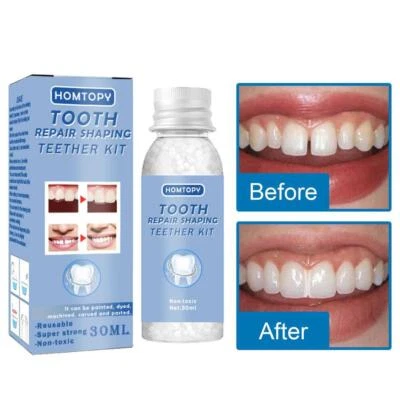 Strong Tooth Repair Permanent Dental Cement Cavity Best Filling Tooth Kit >UK<