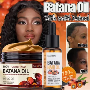 Batana Oil For Hair Growth, Pure Natural Botana Oil Cream Hair Loss Treatment - Picture 1 of 38