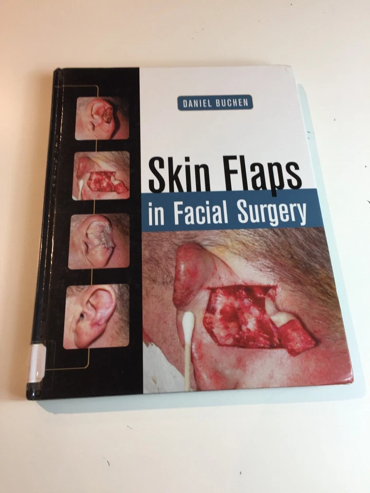 Skin Flaps in Facial Surgery - Image 1 of 4