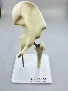 New 1/3 Artificial Hip Joint replacement Medical Anatomical Skeleton demo model - Picture 1 of 6