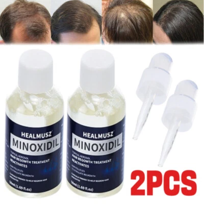 2 x Minoxidil 5% Natural Hair Growth Oil Hair Regrowth Anti Hair Loss Treatment - Image 1 of 4