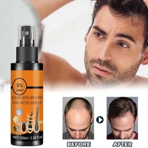 100ml Hair Growth Spray 5 % Mino xidil For Men Women Regrowth Hair-New - Picture 1 of 12