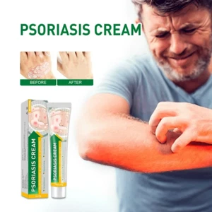 Cuidado de la salud Psoriasis Crema Eczema Ungüento Cuero cabelludo Psoriasis Mano Tiña Pie - Imagen 1 de 6