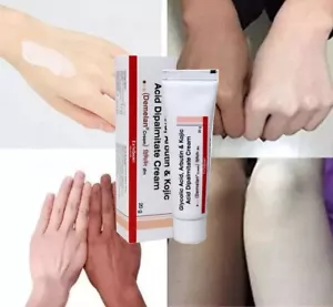 Demelan Cream For Hyperpigmentation Treatment , 20 g (Pack of 1) - NEW**2024 - Picture 1 of 5