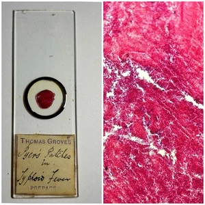 Antique Microscope Slide. Pyre’s Patches In Typhoid Fever. By Thomas Groves. - Picture 1 of 2