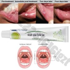Relief Mouth Ulcer Famous Natural Herbal Oral Antibacterial Cream Relief Pain