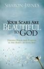 Your Scars Are Beautiful To God: Finding Peace And Purpose In The Hurts Of You..