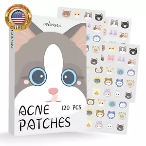 Pimple Patches,Acne Patches,Pimple Patches for Face, Cute Stickers,Salicylic Aci - Picture 1 of 6