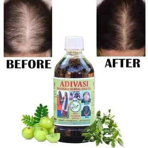 Natural Adivasi Bhringraj Herbal Hair Oil 100ml Made With Pure Ayurvedic Herbs - Picture 1 of 9