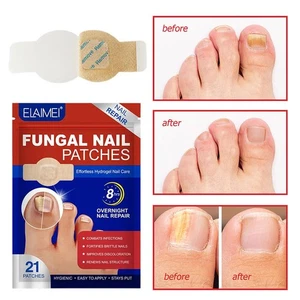 Parche antiséptico de uñas de los pies 21 piezas parche de uñas transpirable transpirable nuevo - Imagen 1 de 6