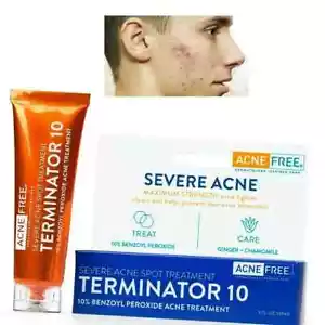 Crema Para Las Espinillas Tratamiento Quita Acne Puntos Negros Eliminar Barros - Picture 1 of 7