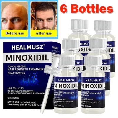 HEALMUS 6 Monats-Vorrat Extra Strength MINOXIDIL 5% Haarwachstum FÜR MÄNNER 6 x 50ML