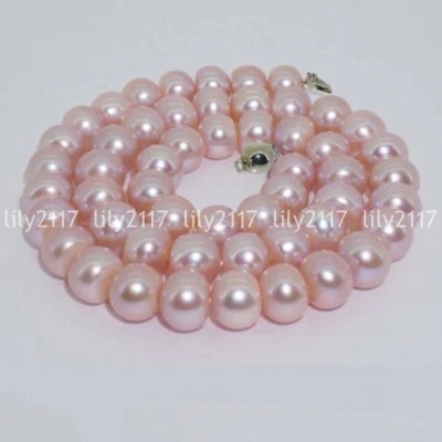 Moda 9-10MM Redondo Genuino Natural Rosa Perla Agua Dulce Collar Encaje 18"" Foto 1 de 3