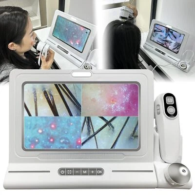 MYCHWAY Skin Diagnosis Hair Analyzer Hair Scalp Detector Analyzer 50X 200X Dual Lens