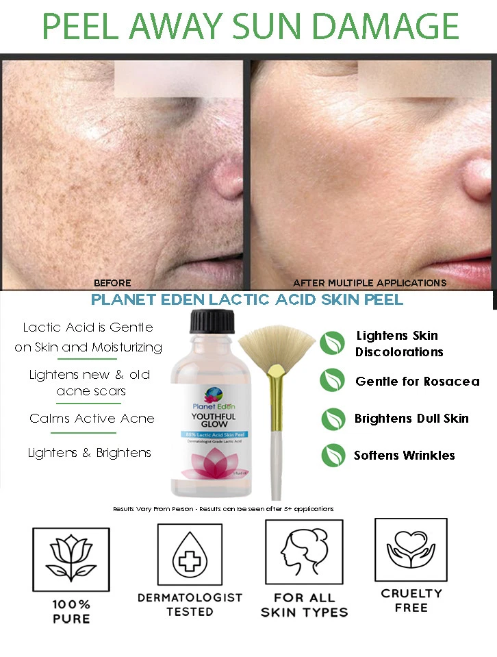 Purest Grade Lactic Acid Peel for DARK SPOTS, Sun Damage, Wrinkles & AGE SPOTS - Image 1 of 1