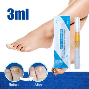Anti Fungal Nail Treatment Finger Toe Care Nail Fungus Biological Repair Pen ·· - Picture 1 of 11