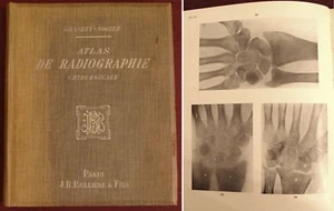 Grashey. ATLAS DE RADIOGRAPHIE CHIRURGICALE. Paris. Baillière et Fils. 1910. - Picture 1 of 1