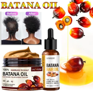Natural Batana Oil Spray For Hair Growth Healthier Thicker Fuller Anti Hair Loss - Picture 1 of 26