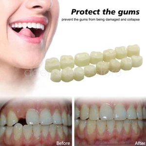 Dental Oral Temporary Anterior Posterior Teeth Crown Caps Tooth Synthetic Resin - Picture 1 of 16