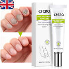 EFERO Nail Anti Fungal Infection Gel Treatment Foot Hand Cream Fungal Remover