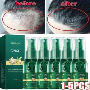 Fast Hair Growth Spray Anti Hair Loss Fast Regrowth Scalp Treatment Serum 30ML - Picture 1 of 28