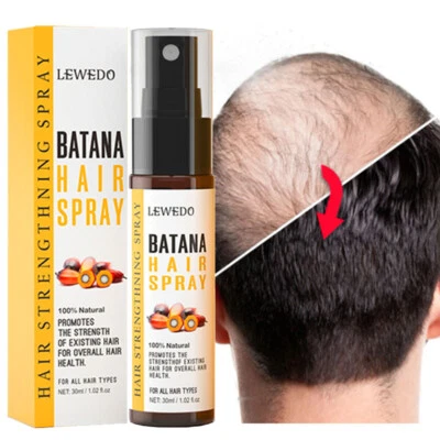 LEWEDO Batana Oil For Hair Growth Spray- Natural Botana Oil Spray- Promotes Hair Health