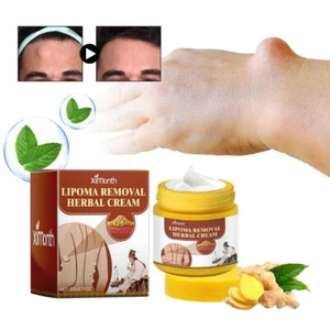 1*20g Lipoma Removal Cream Plant Extract Treat Skin Swelling Ointment Relief UK - Picture 1 of 11