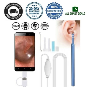 Endoscopio Para Oidos LImpiador De Oidos Orejas Removedor De Cera Boroscopio  - Bild 1 von 12