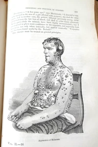 THE AMERICAN PRACTICE OF MEDICINE by W. BEACH, M.D. Vol. II of 3. Published 1855 - Picture 1 of 15