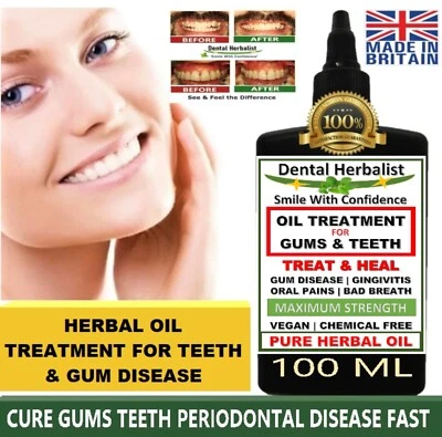 DENTAL HERBALIST FAST POTENT REMEDY Gum Disease Stop Bleeding Receding Gums VEGAN 100 ML