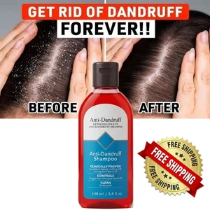 Anti dandruff hair care shampoo relief flaking, scaling, itching | 100% Formula - Picture 1 of 11