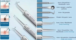 8 piece Acne Needle Kit Blackhead Remover Pimple Comedone Extractor Tweezer Tool - Picture 1 of 6