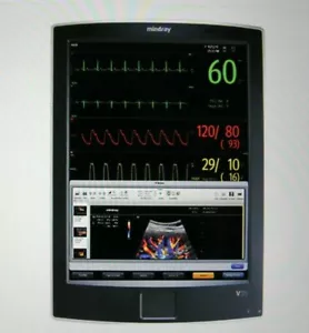 Mindray V21 V21 Patientenmonitor am Nachtbett - Bild 1 von 1