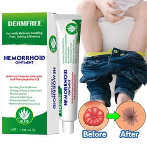 Crema de tratamiento de hemorroides hemorroides pilas anal fisura prolapso crema gel - Imagen 1 de 18