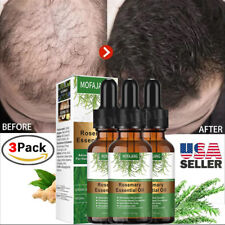 3Pcs Rosemary Essential Oil for Hair Growth, 100% Pure Natural Therapeutic Grade