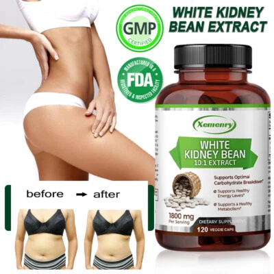 Weiße Kidneybohnen – Fett- und Kohlenhydratblocker,Appetitzügler,Gewichtsverlust - Bild 1 von 4