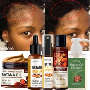 Anti Haarausfall Batana Öl Shampoo Batana Öl Conditioner/Spray für Haarwachstum - Bild 1 von 47