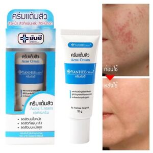 10g YANHEE Acne Cream Reduces Inflammatory Acne Clogged Pores Smooth Facial Skin