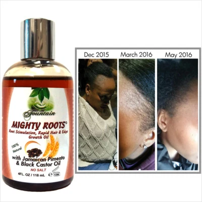 Receding hairline or thin hair growth oil  - Jamaican Pimento Black Castor Oil - Image 1 of 4