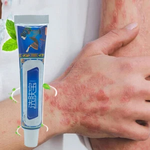 Body Skin Care Cream Anti-Itch Repair Skin Anti Fungal Ointment 15g - Picture 1 of 9