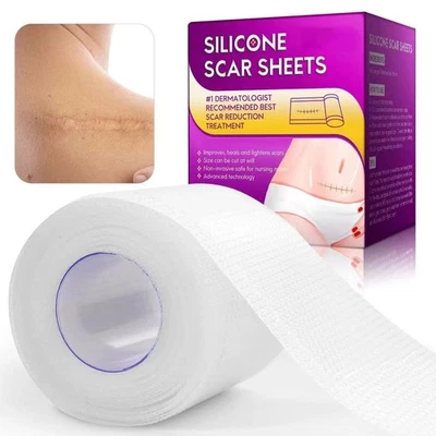 Silicone Scar Tape for Surgical Scars Perfectly Fits Washable & Reusable - Image 1 of 4