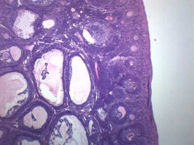 Ovario hembra - Diapositiva microscopio preparada - 75x25 mm - Eisco Labs Foto 1 de 2