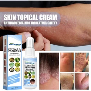30ml Skin Psoriasis Spray Natural Herb Eczema Treatment Spray Itch Relief New - Picture 1 of 19